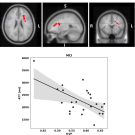 Brain MRI slices with red arrows; scatter plot with negative trend.